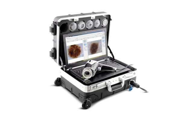 Vidix Portable Cofiguration Digital Dermoscopy Device