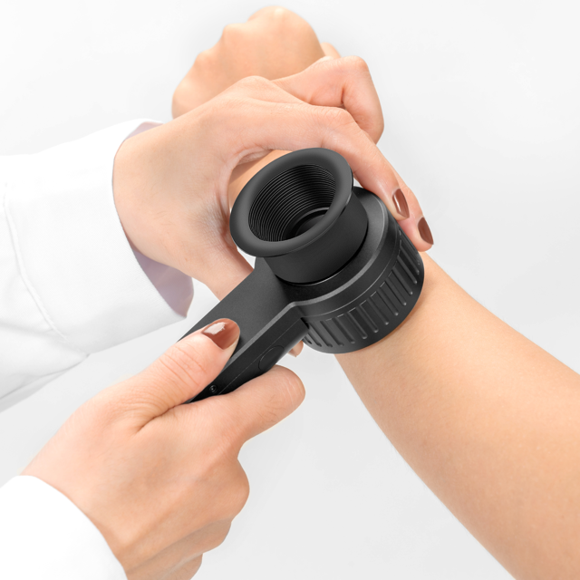 Skinlite DE-3100 PRO Dermatoscope - Image 4
